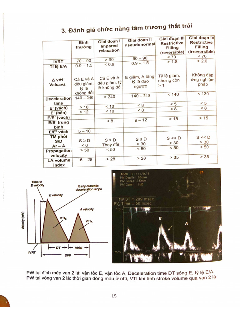 Satcr- Đánh Giá Chức Năng Tâm Trương Thất Trái | PDF