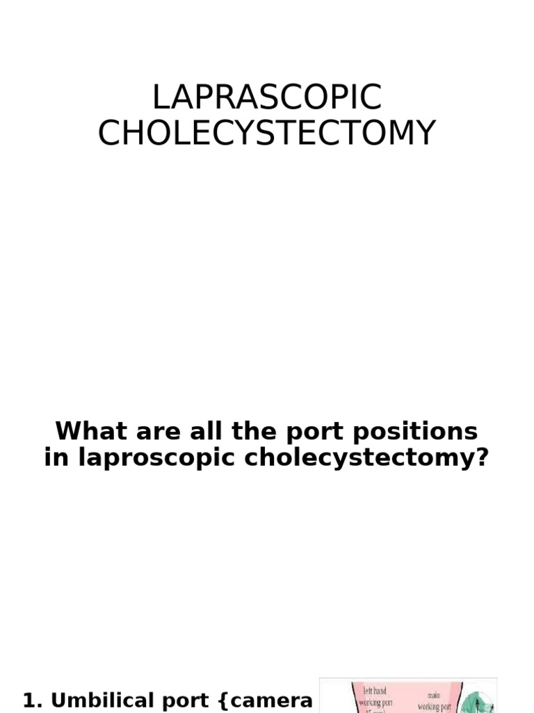 Laparoscopic Cholecystectomy Guide | PDF