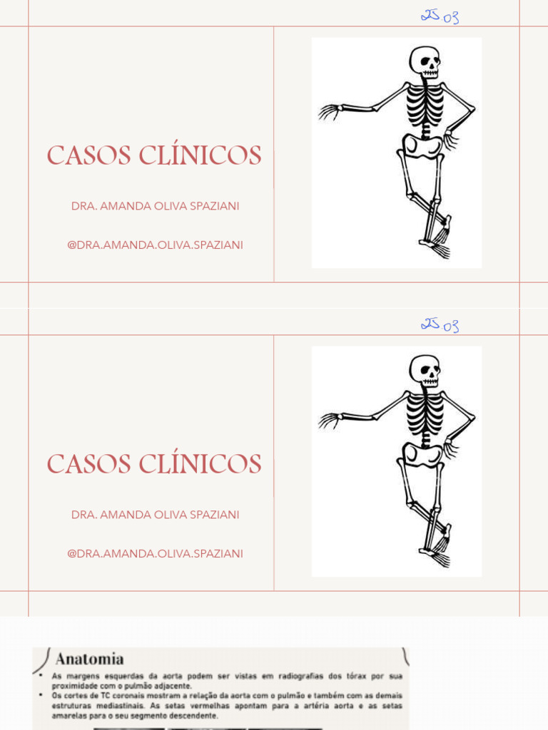 CASO CLÍNICO - Aleatórios - 250408 - 110228 | PDF | Tórax (anatomia ...