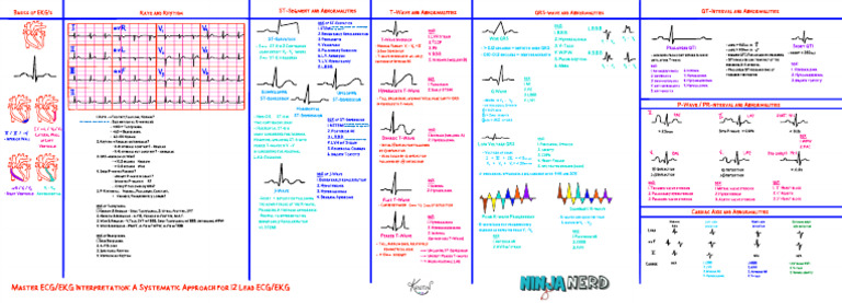 Infarctus du myocarde : ST et hypertrophie | PDF