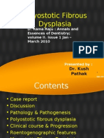 Fibrous Dysplasia - Polyostotic