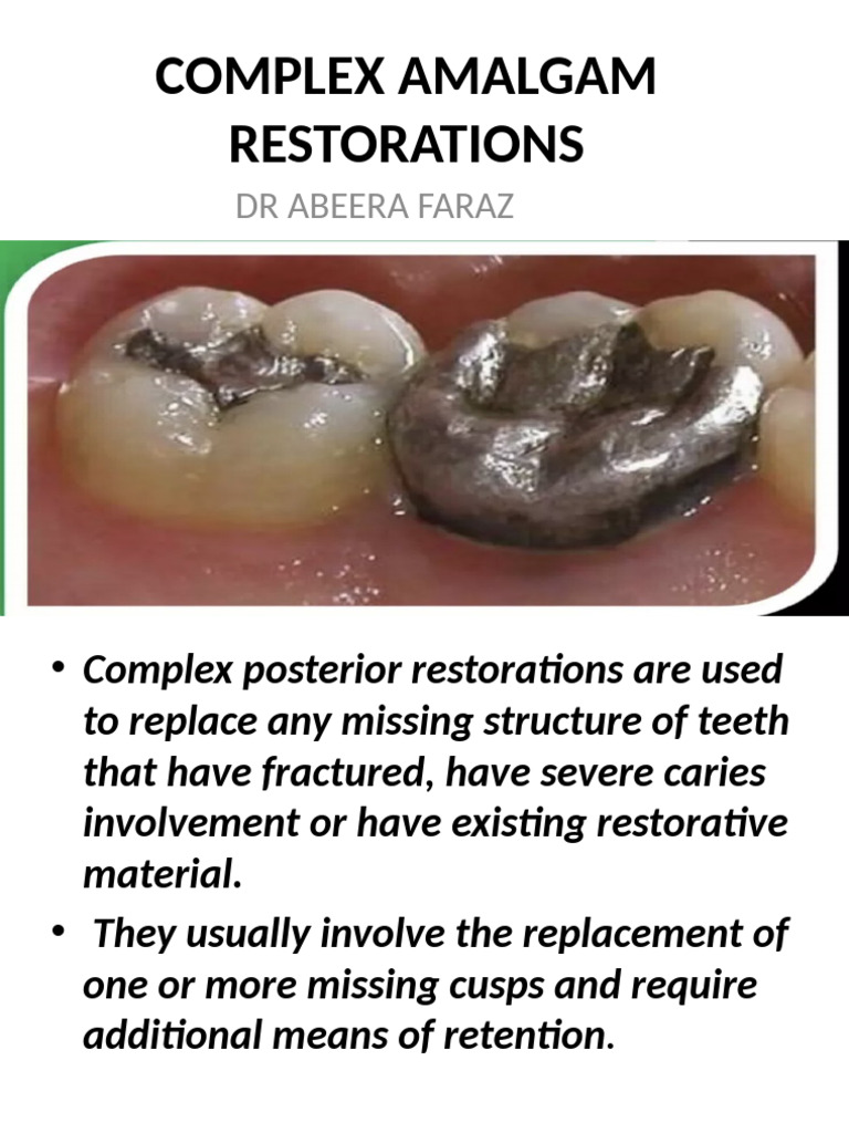 Complex Amalgam Restorations Overview | PDF | Medical Specialties | Tooth