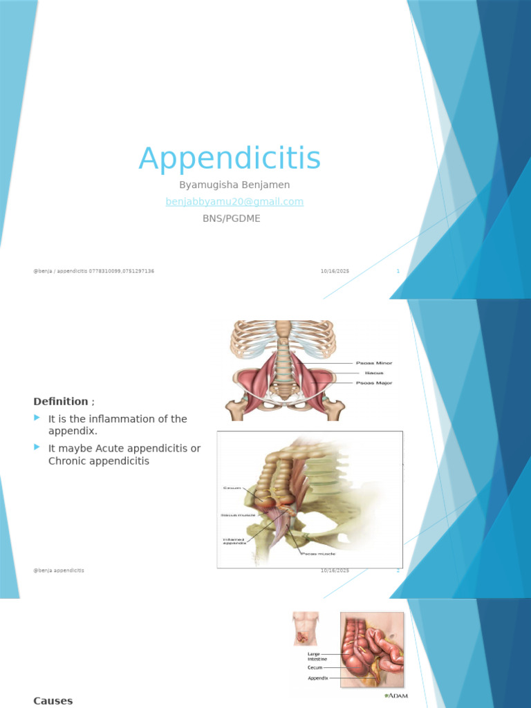 Understanding Appendicitis: Causes, Symptoms, and Treatment | PDF ...