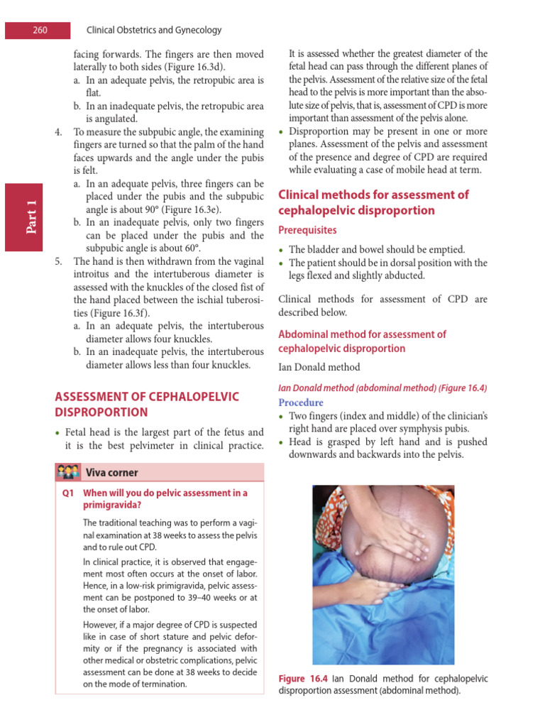 Cephalopelvic Disproportion Assessment | PDF | Pelvis | Childbirth