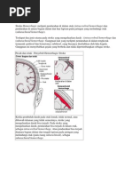 Download Hemorrhagic Stroke by Mahfuddin Bustan SN93415765 doc pdf