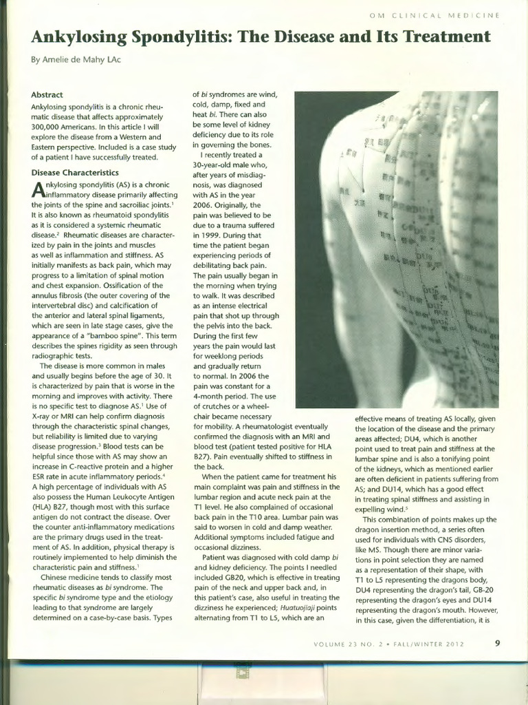 Ankylosing Spondylitis: Overview & Treatment | PDF | Clinical Medicine ...