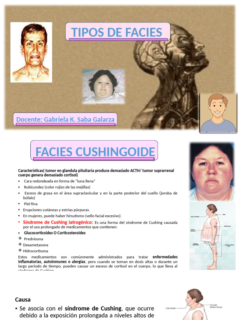 FACIES | PDF | Hipertiroidismo | Tiroides