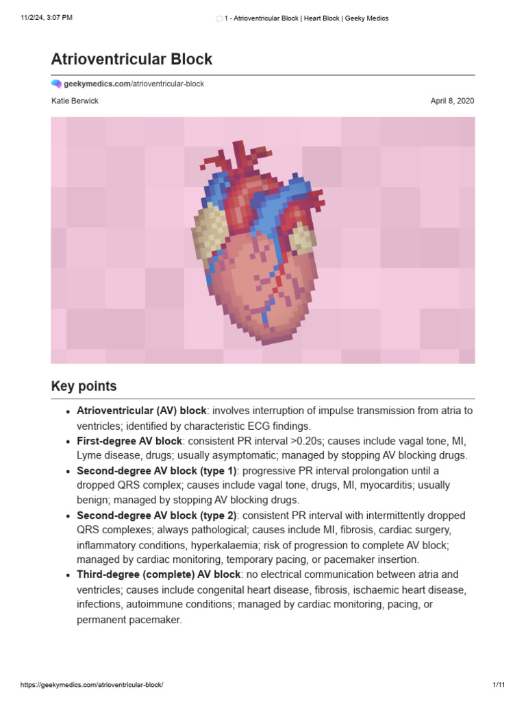 Atrioventricular Block - Heart Block - Geeky Medics | PDF | Heart ...