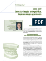 Ortodoncia-Multidisciplinar-24_1-10_Caso-N%C2%BA-43