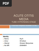 Acute Otitis Media