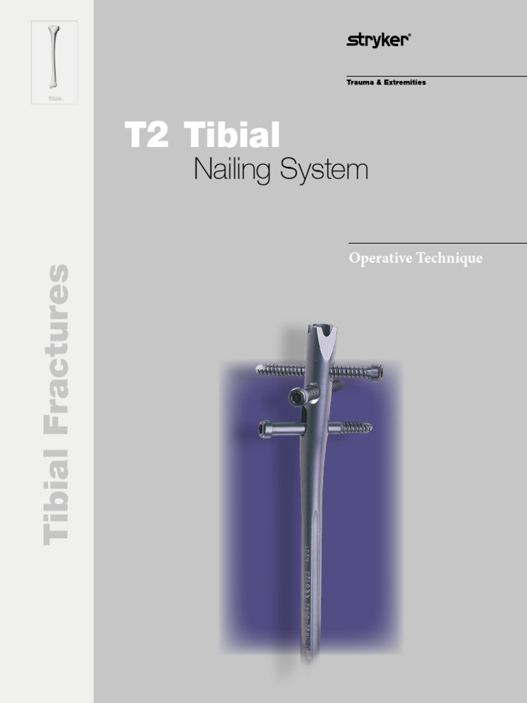 Advanced Tibial Nailing Techniques Guide | PDF | Knee | Screw