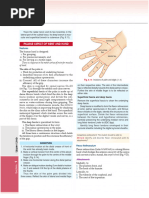 Flexor Retinaculum: Anatomy & CTS | PDF