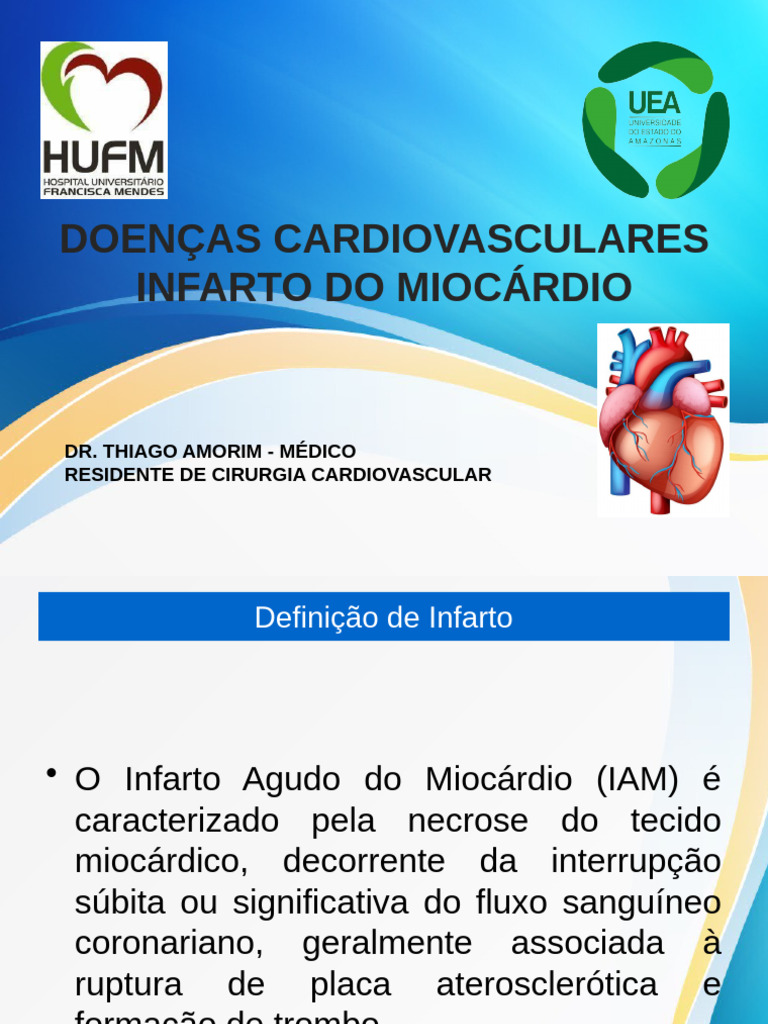 Infarto do Miocárdio: Causas e Tratamento | PDF | Infarto do Miocárdio ...