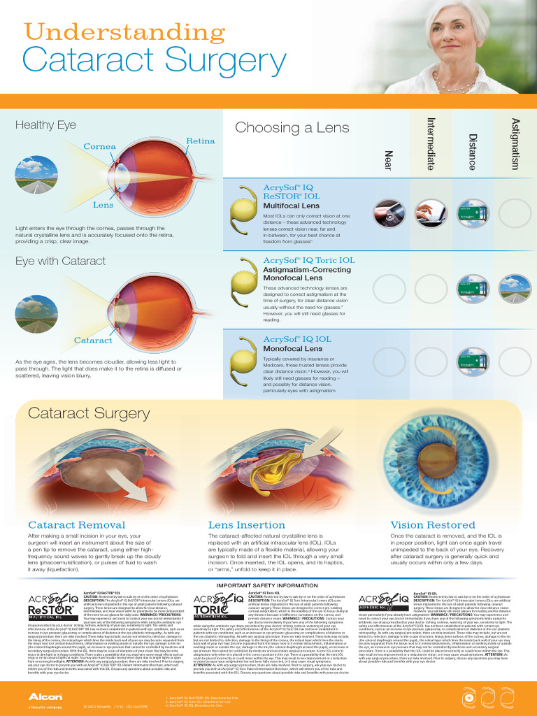 Comprehensive Guide to Cataract Surgery | PDF | Sensory Organs | Face