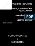 Infecções Genitais (Vulvovaginites, Cervicites, DIPA, HPV e Úlceras)