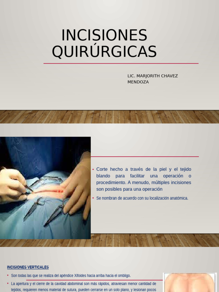 Incisiones Quirúrgicas Abdominales | PDF | Abdomen | Músculo