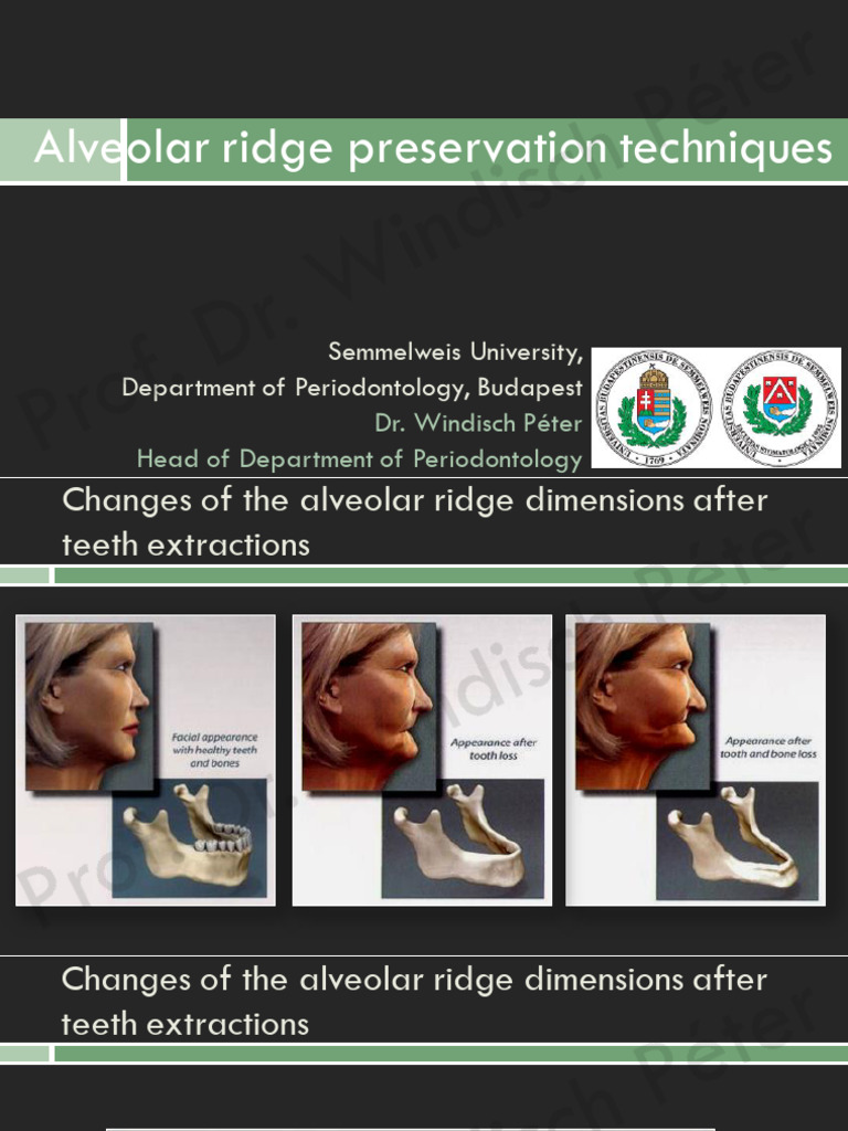 ParA3osz2018WP Alveolar Ridge Preservation Techniques | PDF | Dental ...