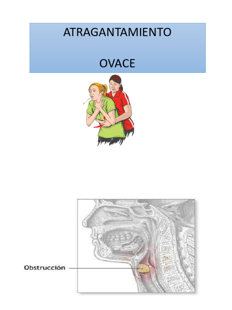 OVACE | PDF