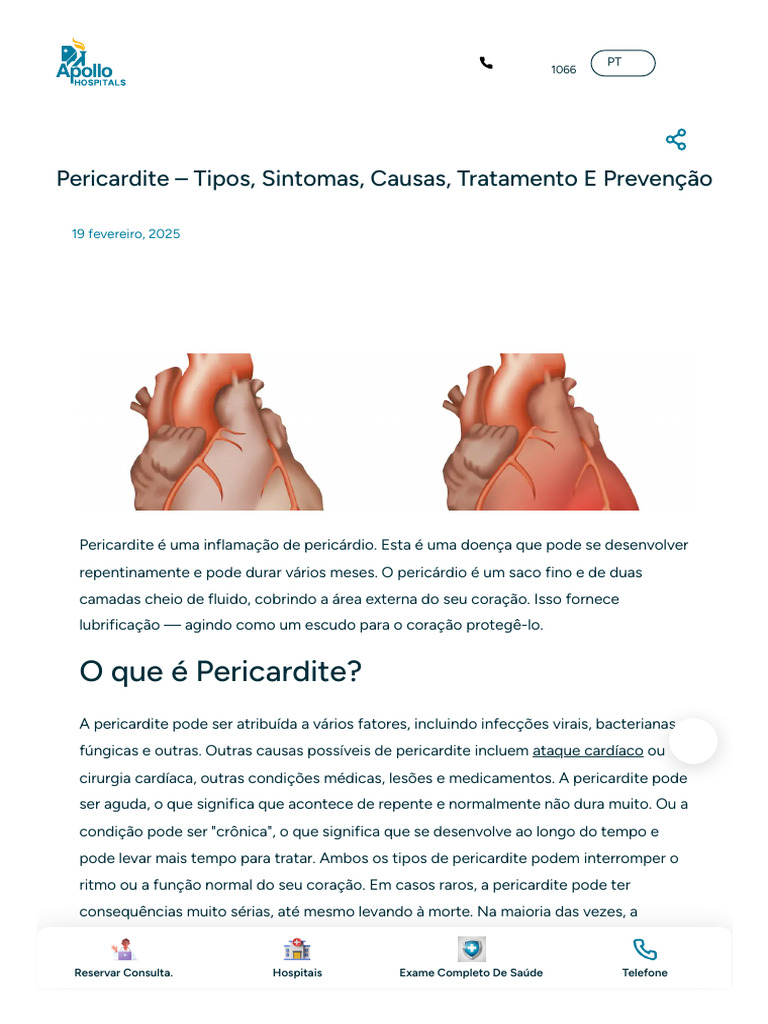 Pericardite: Tipos, Sintomas e Tratamento | PDF | Coração | Dor