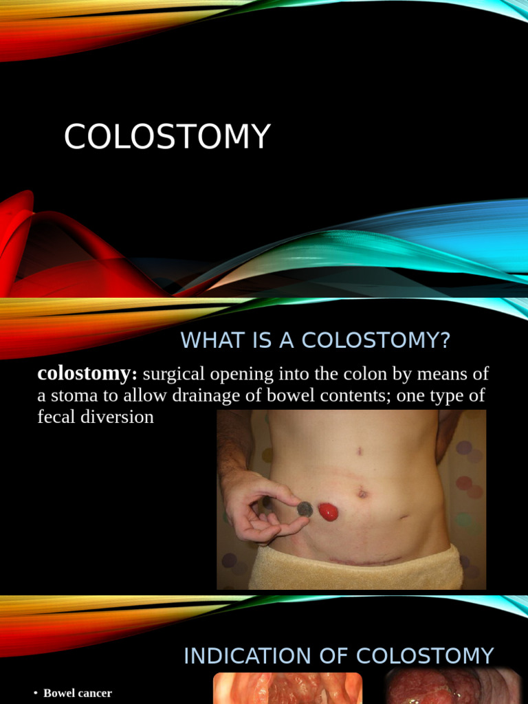 Colostomy GHJKL 'Erfgfguiopdfghiopvbnjklghj | PDF | Surgical ...