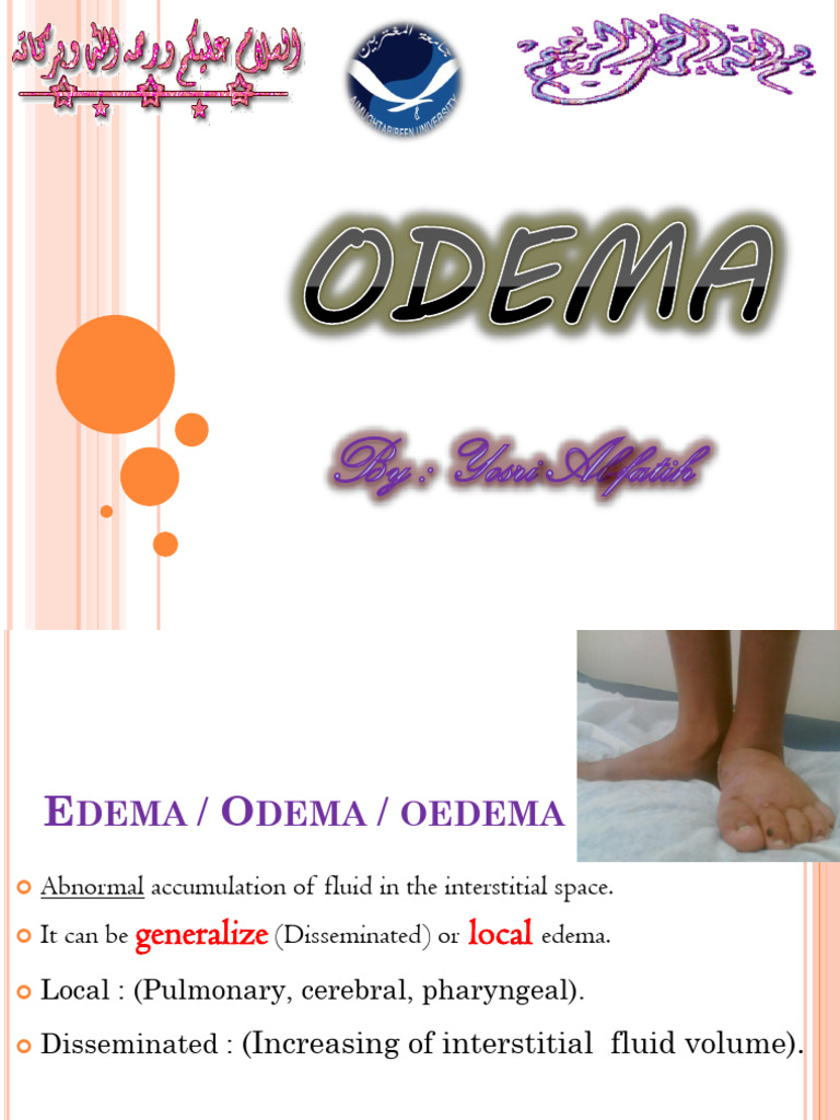 L-13 - Edema | PDF