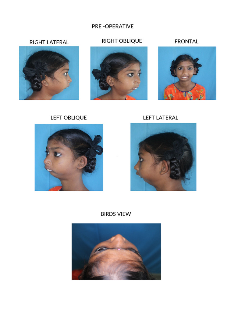 OMFS Pre-Op and Post-Op Imaging Guide | PDF | Dentistry | Dental Anatomy