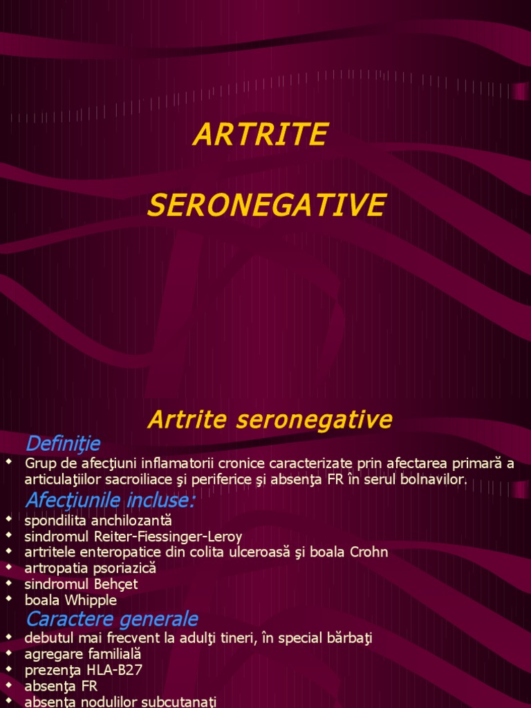 Artrite Sero Negative