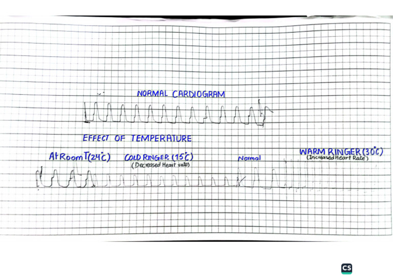 Cardiogram | PDF