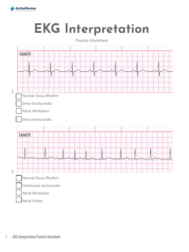 EKG Interpretation Worksheet | PDF | Electrocardiography | Internal ...