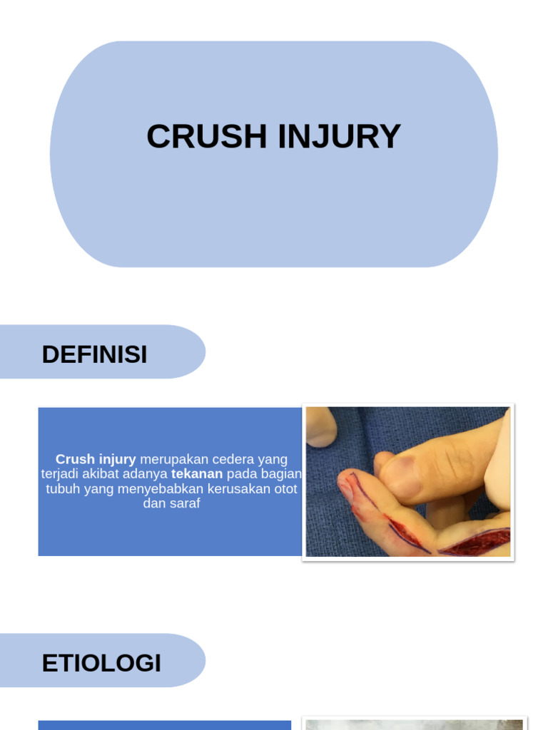 Crush Injury | PDF