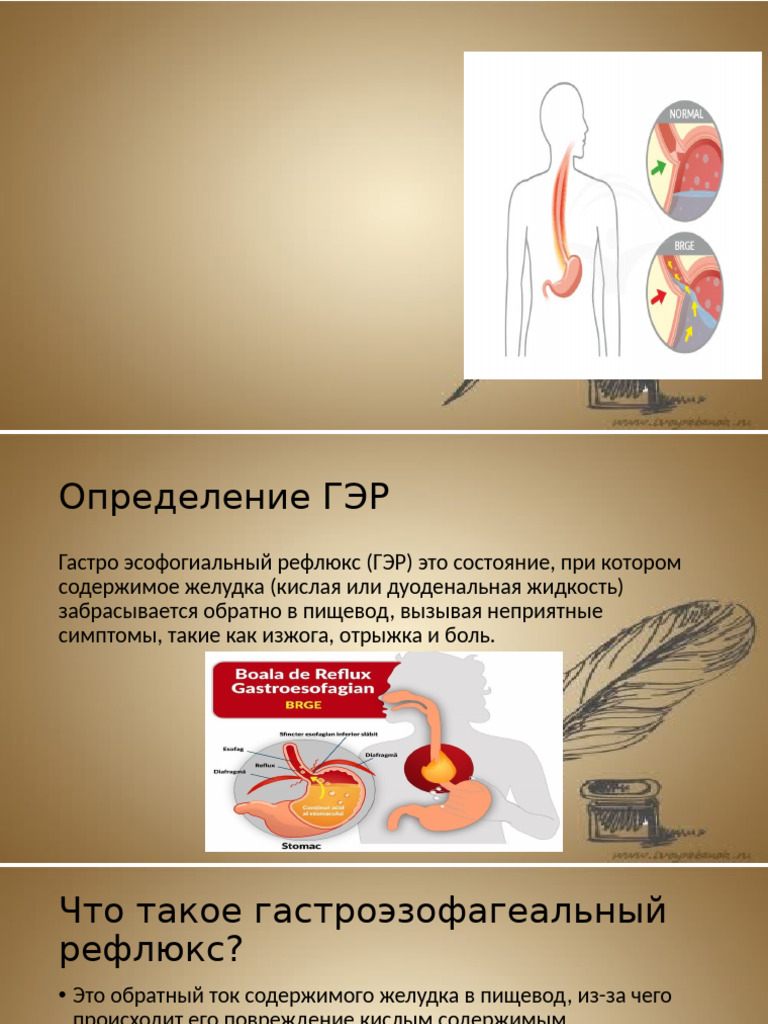 Reflux Gastro Esofagian | PDF