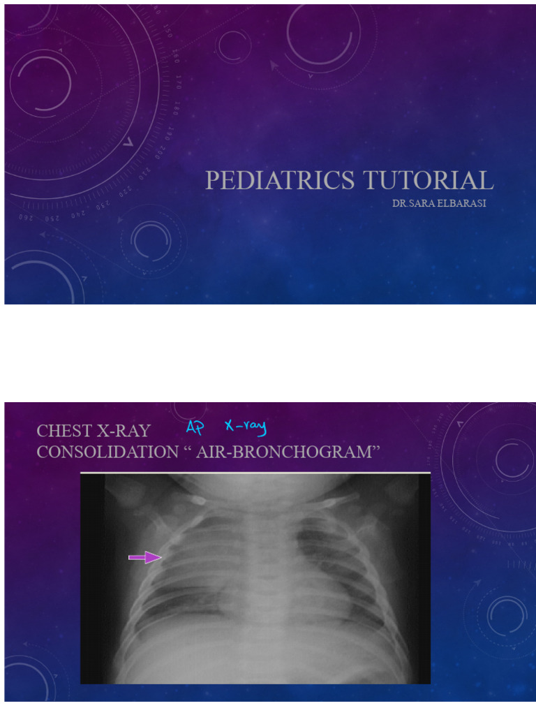Pediatrics Tutorial 2 | PDF