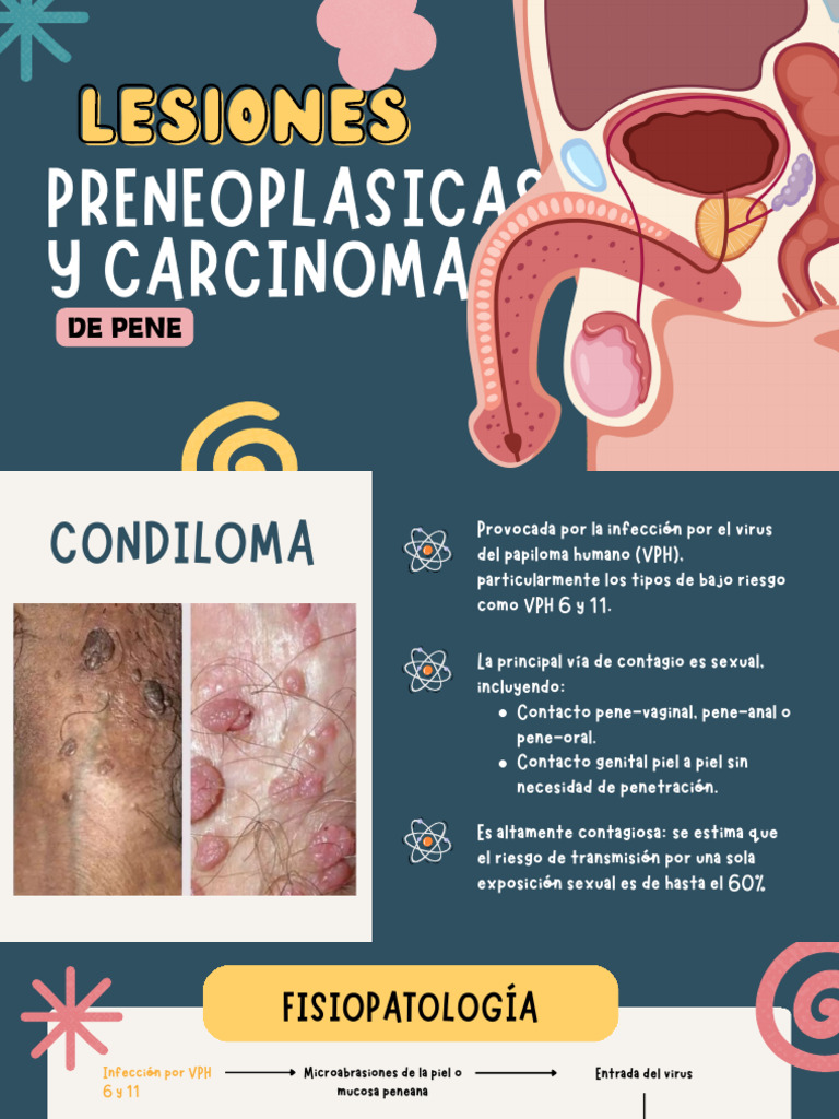 Condilomas y Carcinoma de Pene: Guía Completa | PDF | Especialidades ...