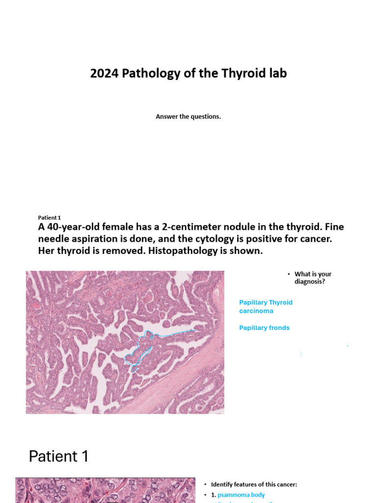 Thyroid Pathology Cases and Diagnoses | PDF | Thyroid | Cytopathology