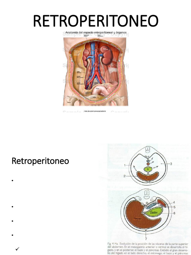 Tema # 9 Retroperitoneo (Organos Lumbares) | PDF | Riñón | Abdomen