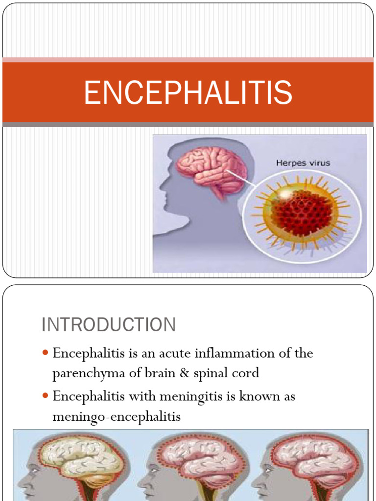 Understanding Encephalitis Symptoms & Causes | PDF | Diseases And ...