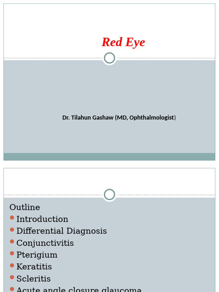 Red Eye | PDF | Glaucoma | Cornea