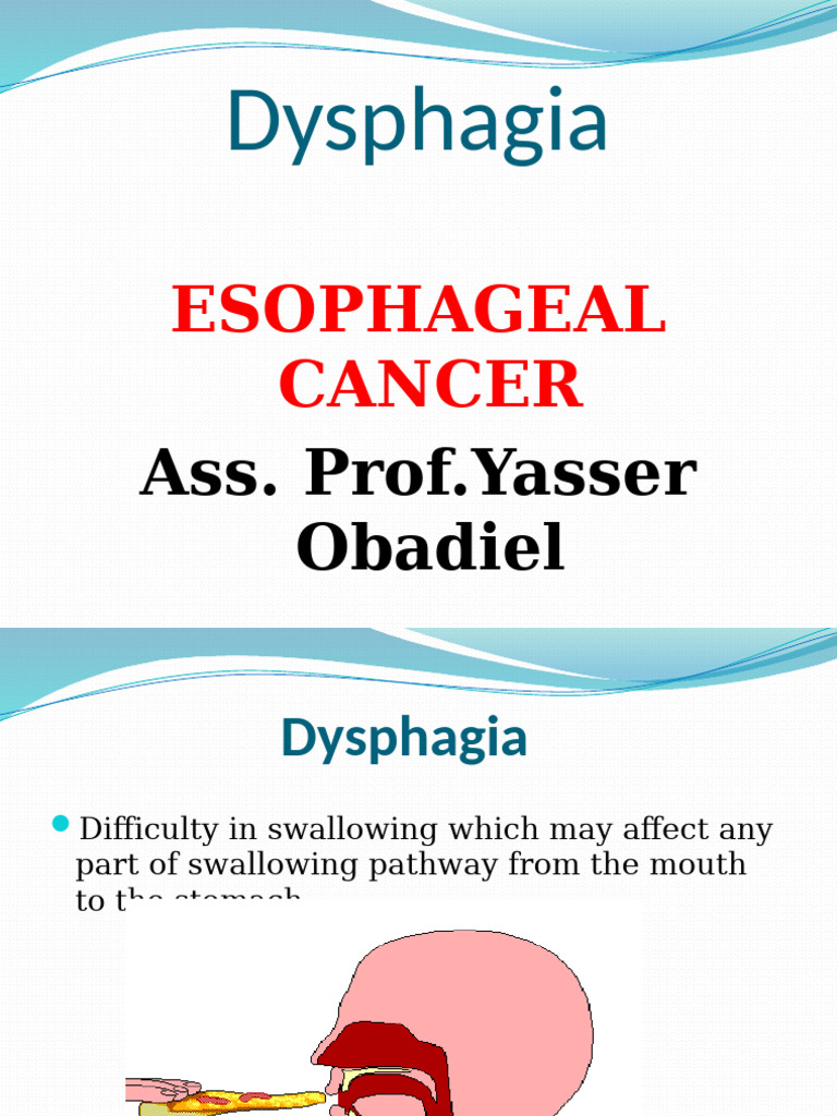 Dysphagia Esophageal Cancer | PDF | Esophagus | Esophageal Cancer