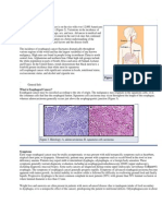 Esophageal Cancer