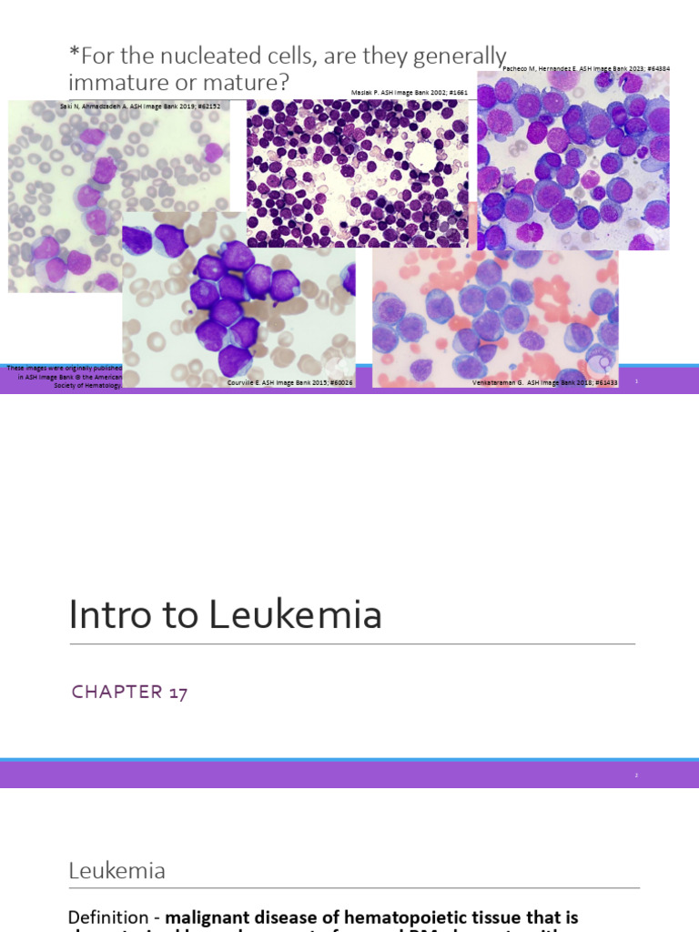 21 - Intro to Leukemias | PDF | Leukemia | Haematopoiesis