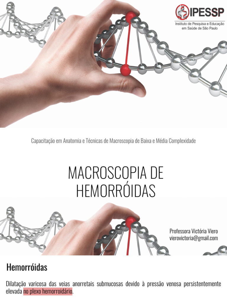 Aula 6 - Hemorróidas | PDF | Hemorroida | Pele