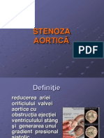 stenoza aortica