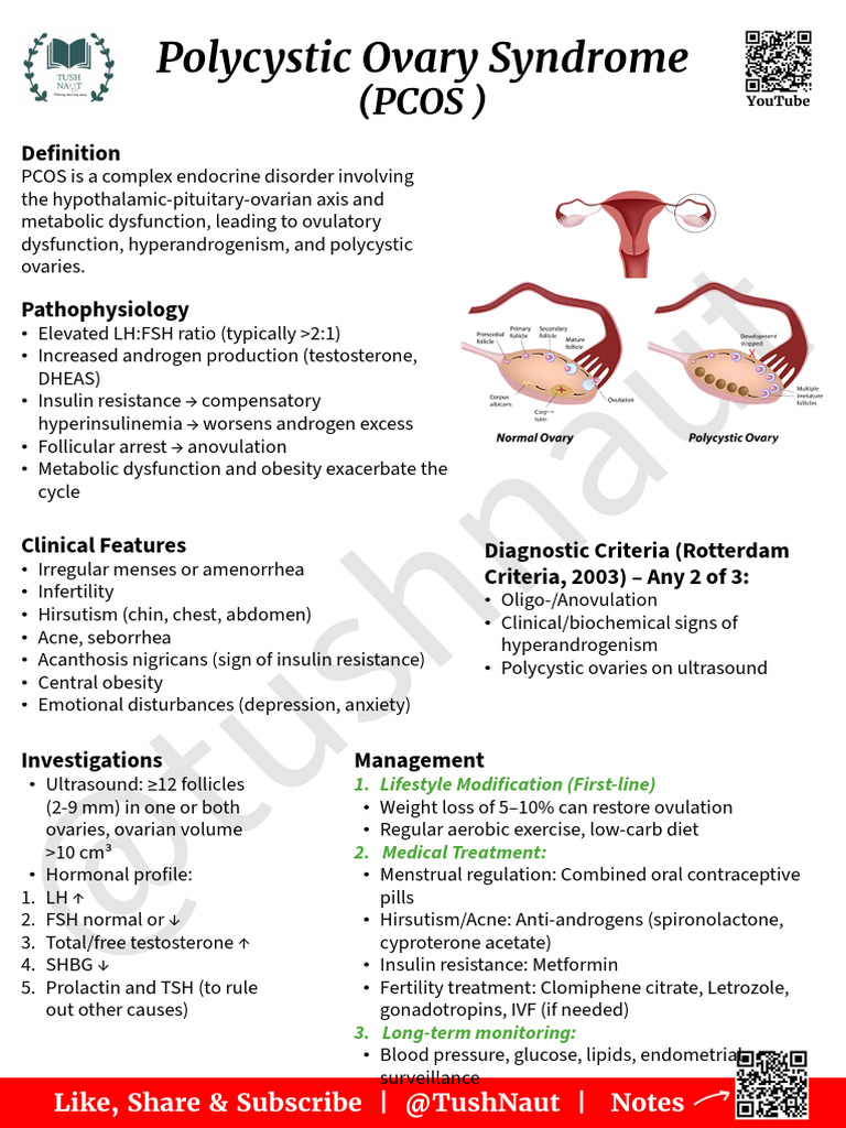 Ρolycystic Οναry Syndrome (PCOS) | PDF | Polycystic Ovary Syndrome ...