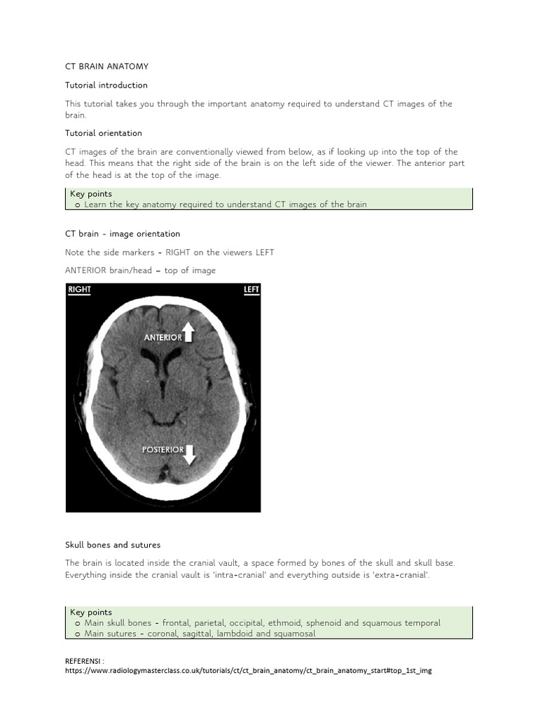 CT Brain Anatomy Overview Guide | PDF | Skull | Skeletal System