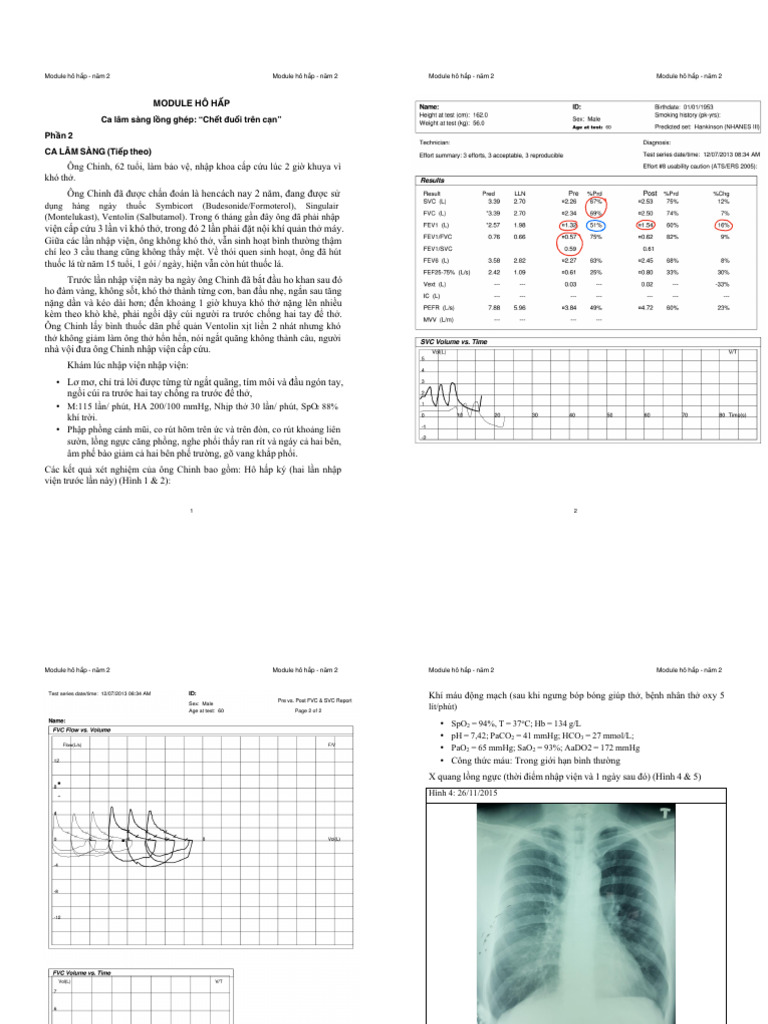 Hen 2 Full | PDF