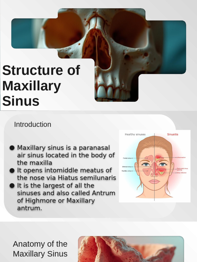 Anatomy of the Maxillary Sinus | PDF