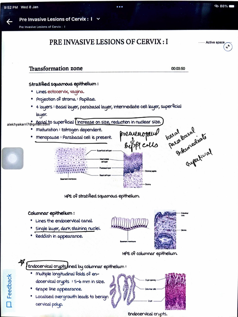 Pre Invasive Lesions of Cervix - 7. Pre Invasive Lesions of Cervix - 2 ...