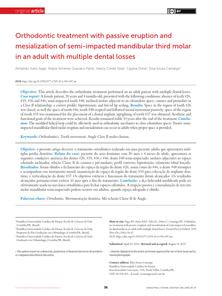 Orthodontic Treatment for Dental Losses | PDF | Dental Anatomy ...