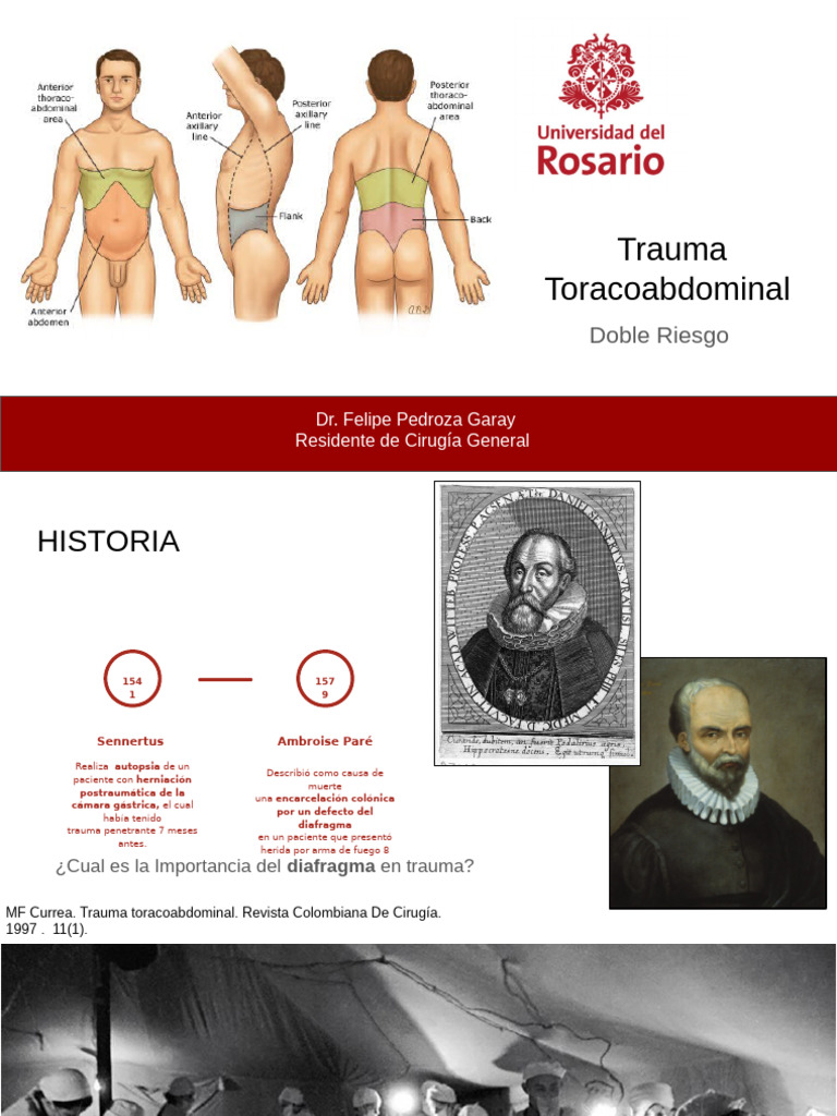 Trauma Toracoabdominal | PDF | Tórax | Emergencias Médicas