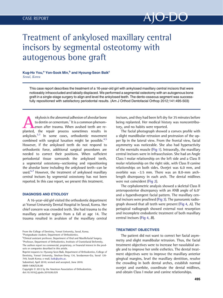 Treatment of Ankylosed Maxillary Central Incisors by Segmental ...